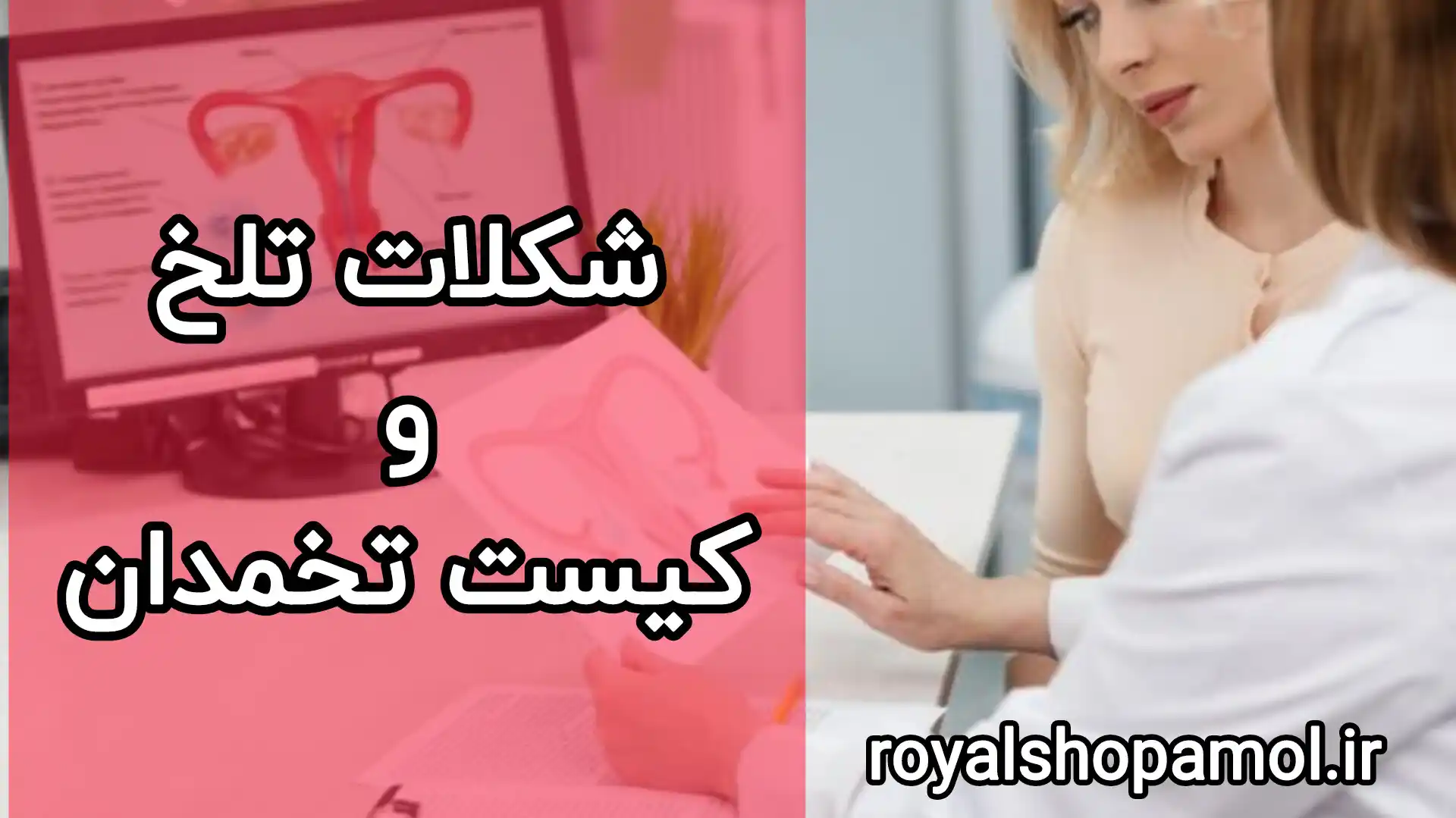 شکلات تلخ و کیست تخمدان